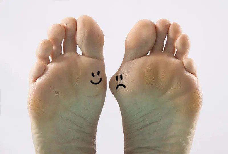 Exercises to Help with Bunion Management