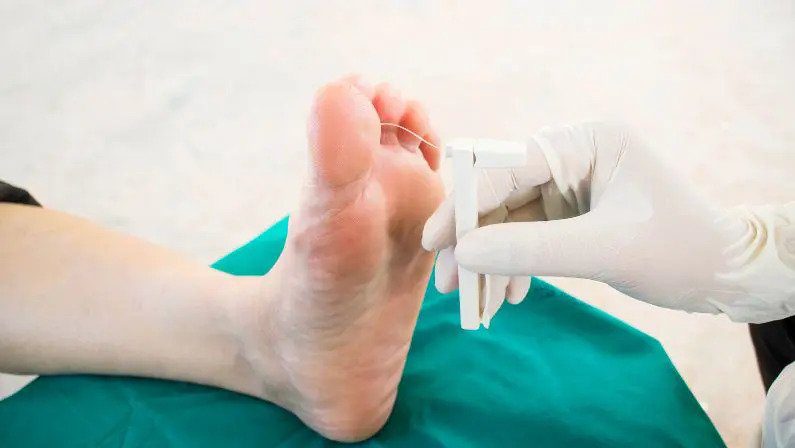 What Is Peripheral Neuropathy And How It Can Be Managed?