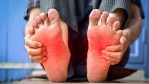 Benefits of Foot Mobilisation and Manipulation Techniques